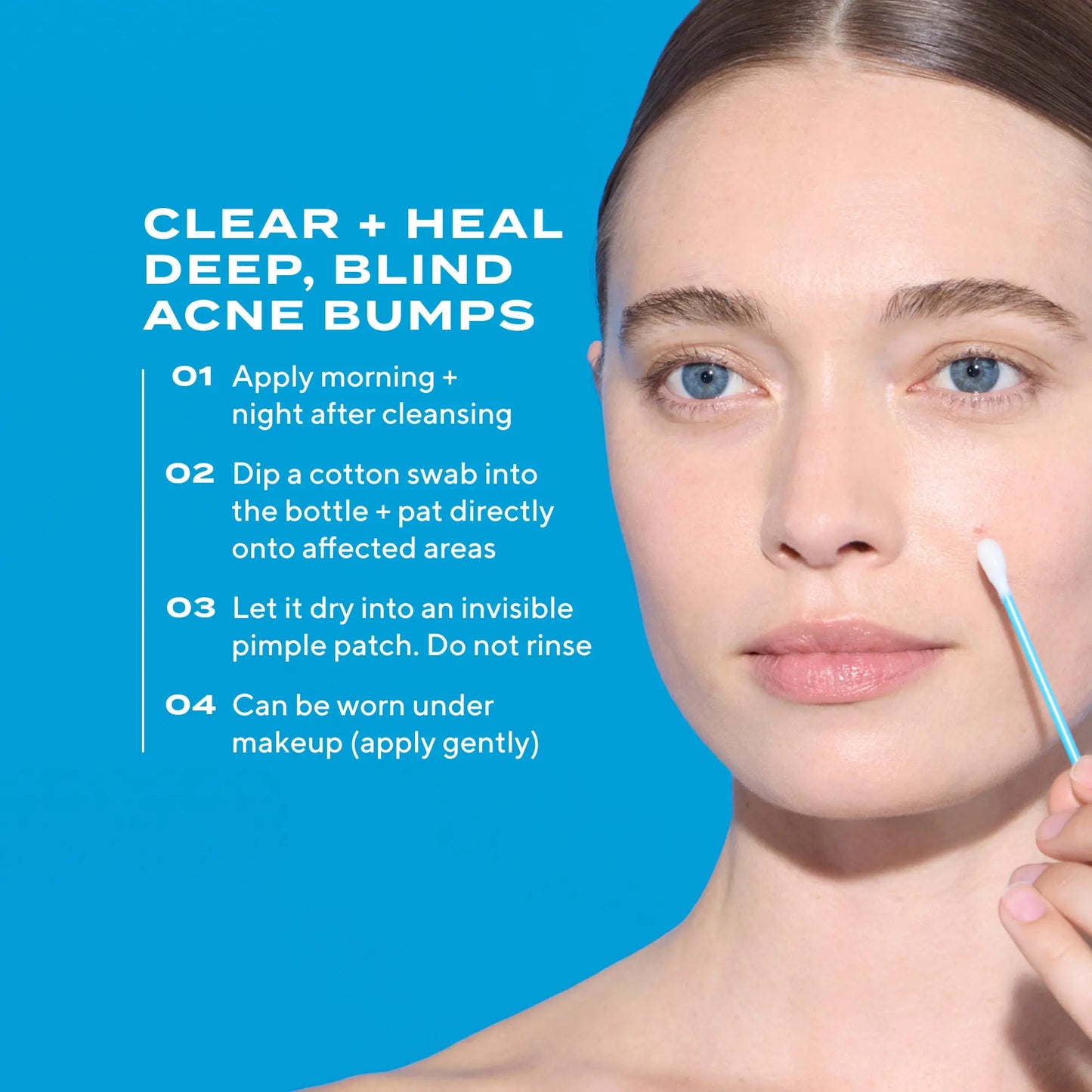 Murad Deep Relief Acne Treatment - 2% Salicylic Acid & Advanced Phytosteroid Technology for Rapid Acne Healing and Skin Restoration