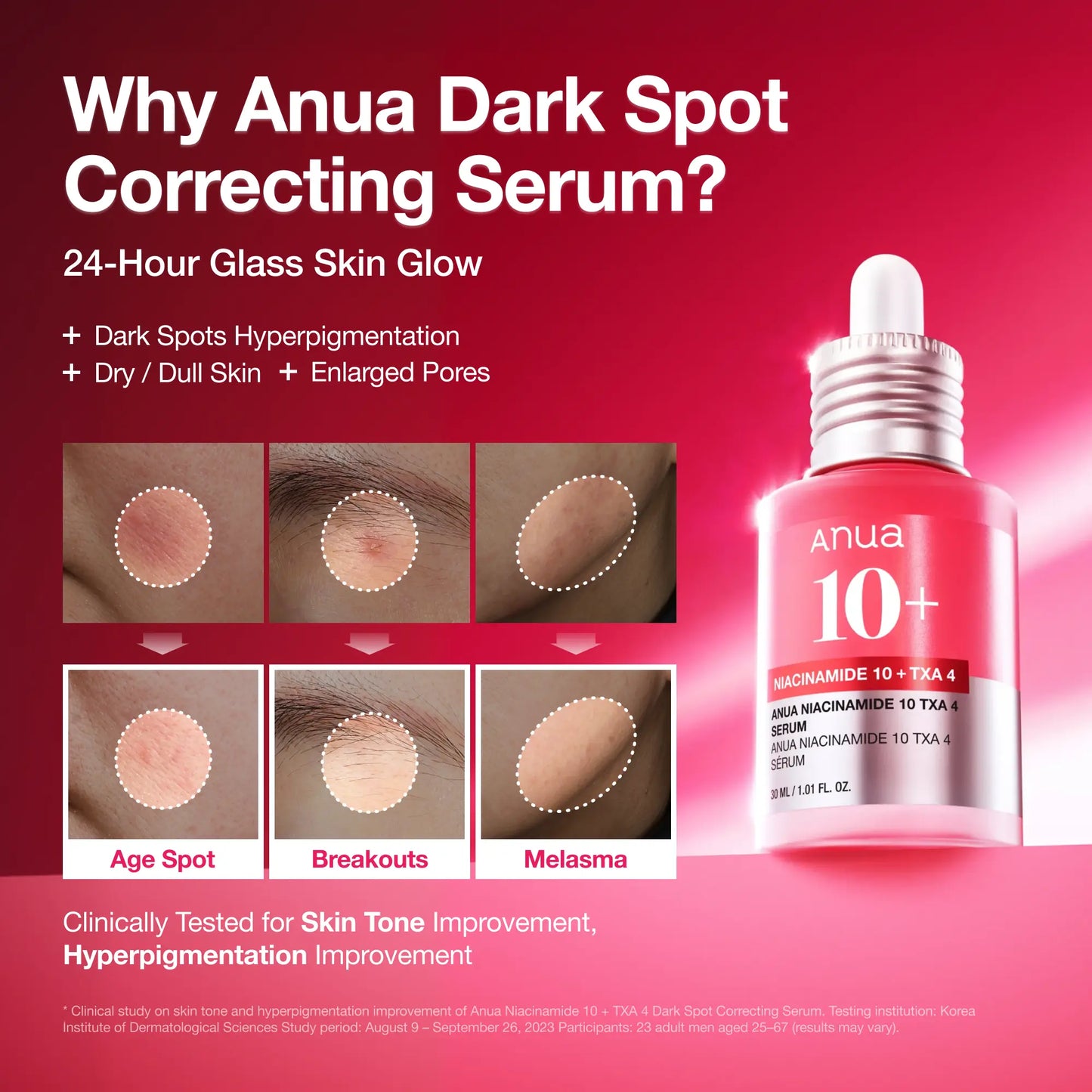 Anua Dark Spot Correcting Serum : 10% Niacinamide+ 4% Tranexamic Acid 1.01 Fl.Oz. (30Ml)