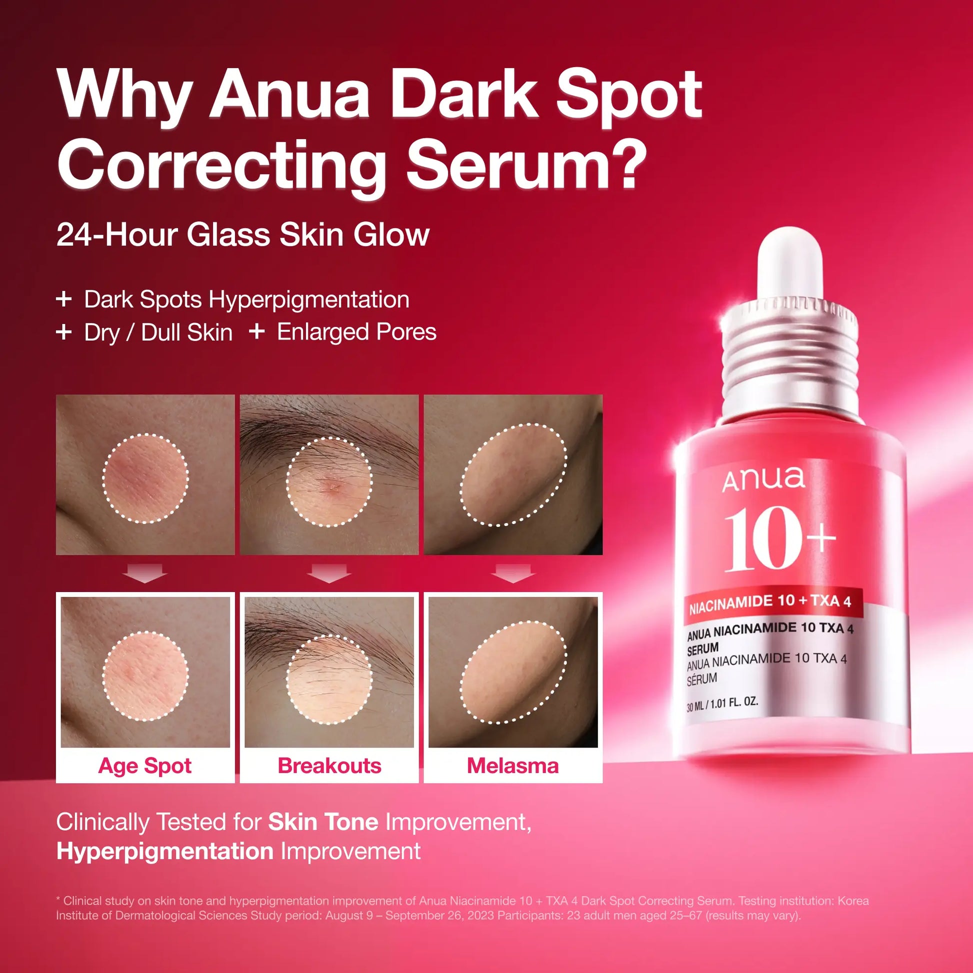 Anua Dark Spot Correcting Serum : 10% Niacinamide+ 4% Tranexamic Acid 1.01 Fl.Oz. (30Ml)