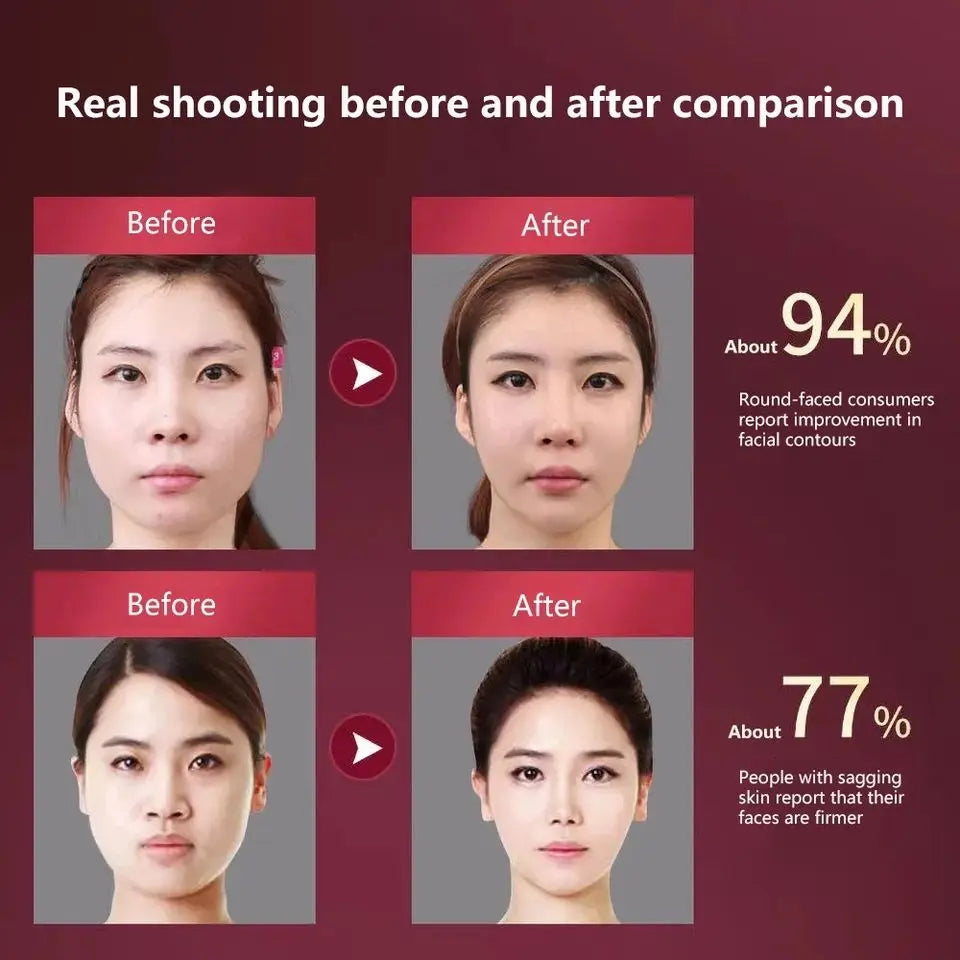 Facial Lifting Massager 12 Gears Electric Facial Massager V-Line Face Lifting Slimming Device