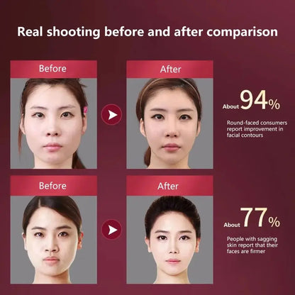 Facial Lifting Massager 12 Gears Electric Facial Massager V-Line Face Lifting Slimming Device
