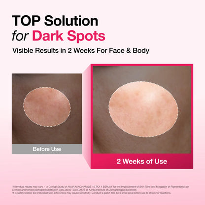 Anua Dark Spot Correcting Serum : 10% Niacinamide+ 4% Tranexamic Acid 1.01 Fl.Oz. (30Ml)