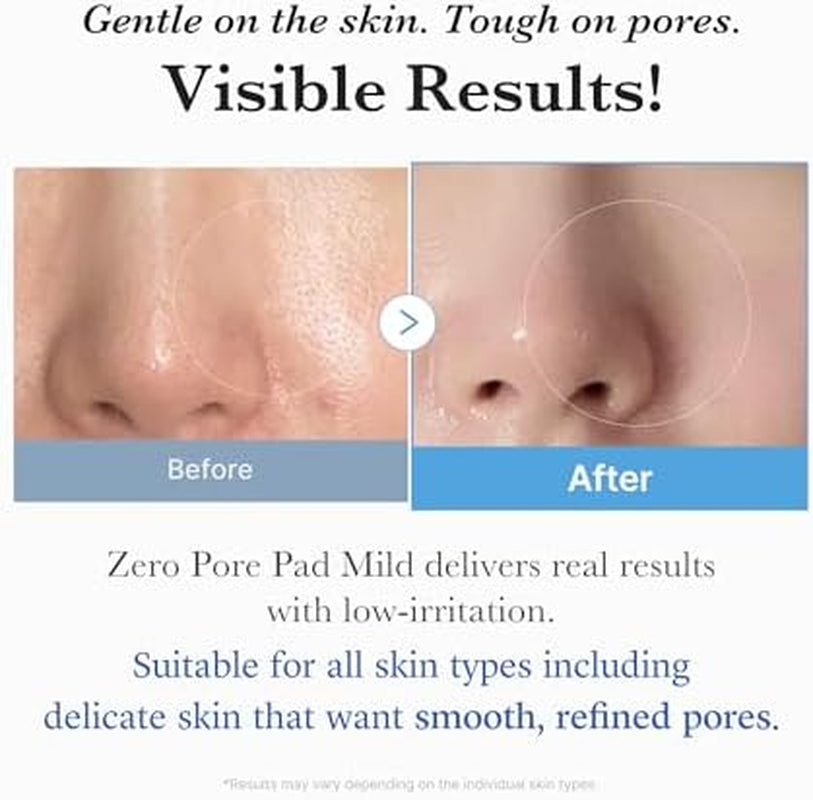 Transform Your Skin with Medicube Zero Pore Cleanse & Swipe Duo: Exfoliating Cleanser and Pore Refining Pads for a Flawless Complexion