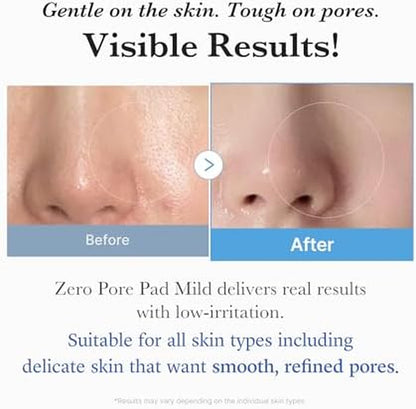 Transform Your Skin with Medicube Zero Pore Cleanse & Swipe Duo: Exfoliating Cleanser and Pore Refining Pads for a Flawless Complexion