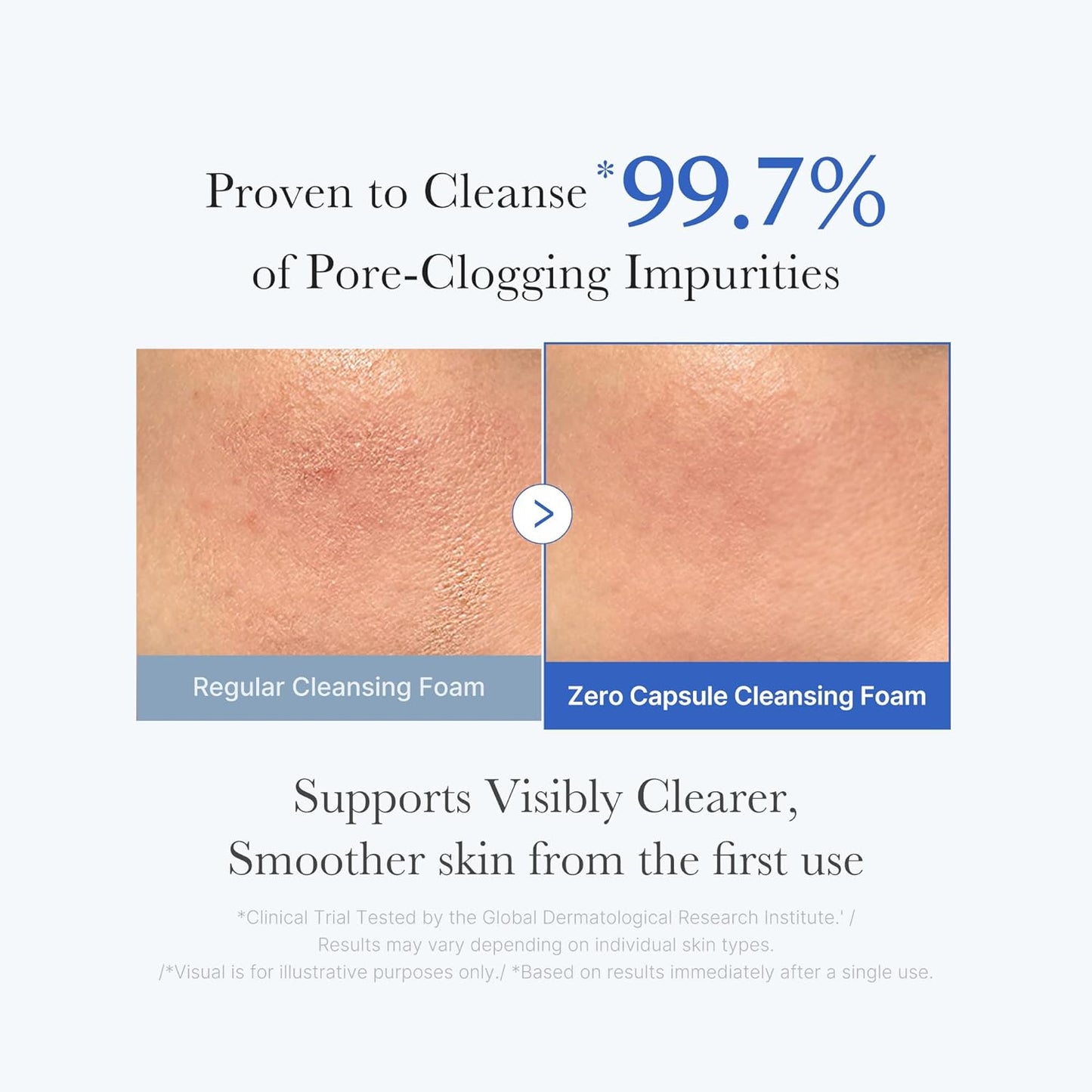 Transform Your Skin with Medicube Zero Pore Cleanse & Swipe Duo: Exfoliating Cleanser and Pore Refining Pads for a Flawless Complexion