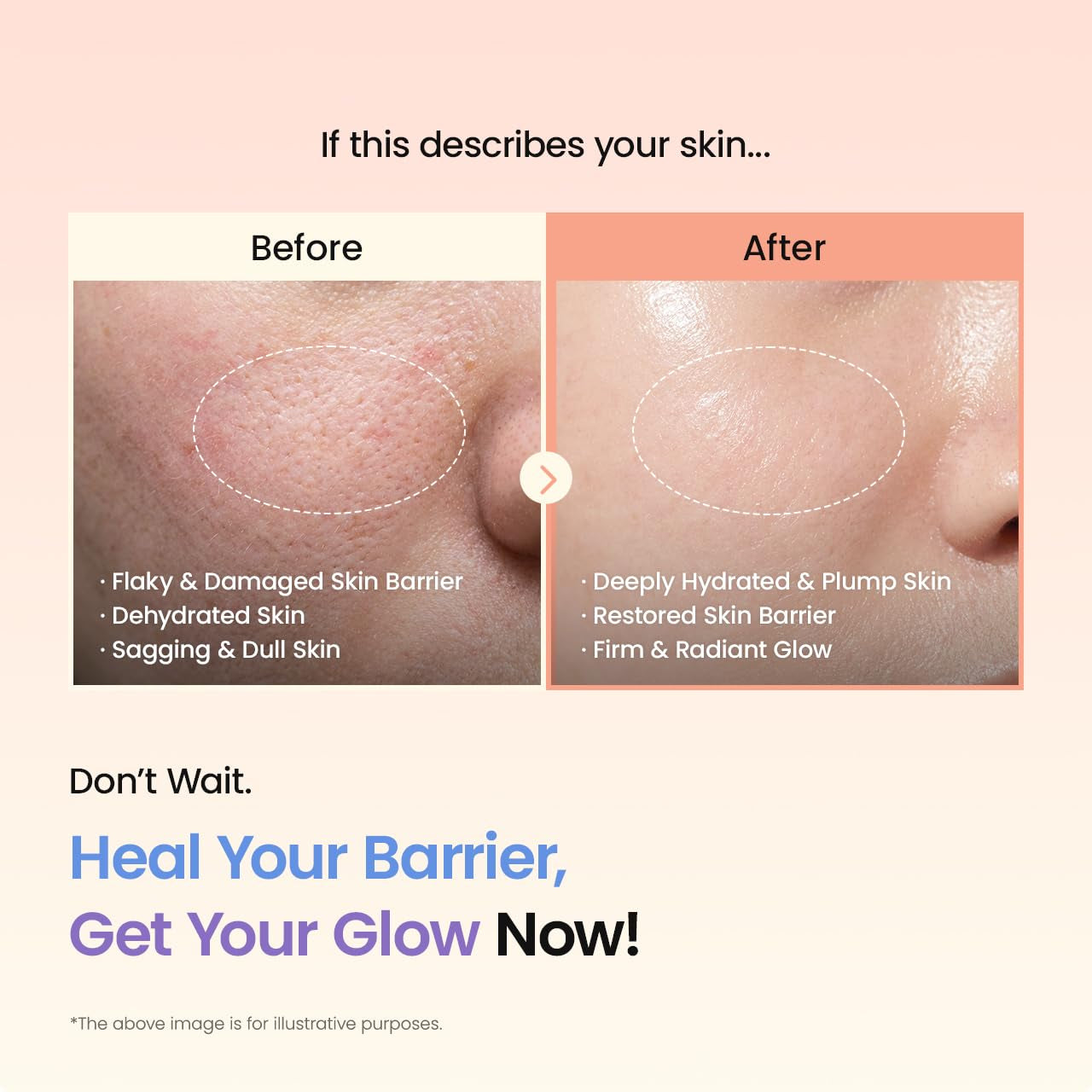 Revitalize Your Skin with Biodance Barrier Rescue Duo: Nourishing Caviar PDRN & Hydrating Ceramide Panthenol
