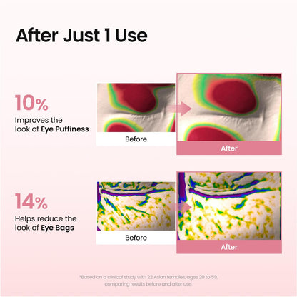 Biodance Collagen Peptide Eye Patches - The Ultimate Anti-Aging Solution