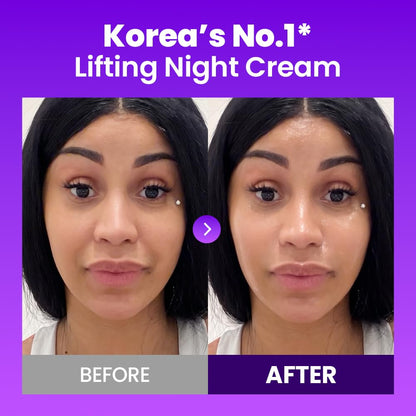 Revitalize Your Skin with the Probioderm 3D Lifting Skincare Set - Cardi B's Ultimate Choice for Youthful Glow!