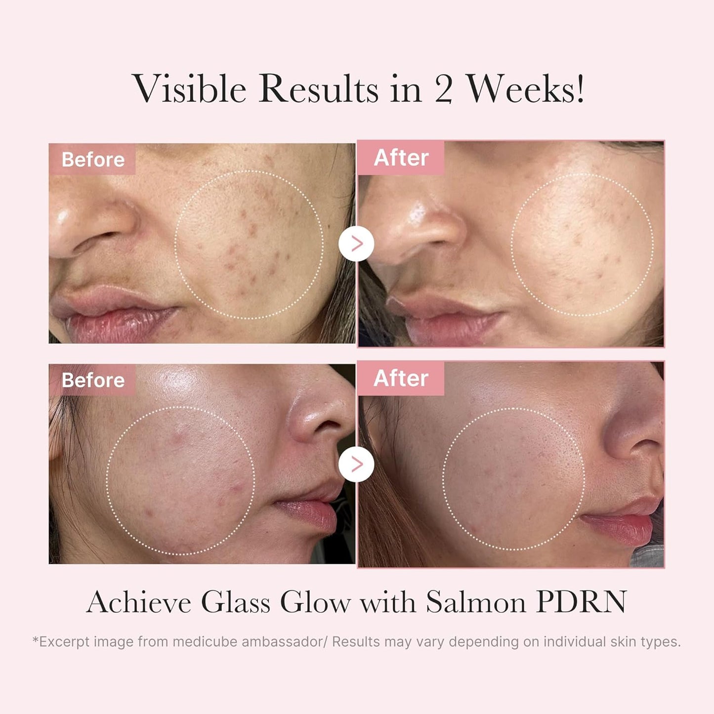 Salmon DNA PDRN Glow Kit | Glass Glow Mini Skincare Set with Toner, Serum & Sheet Mask for Hydrating, Firming, Moisturizing |Gift & Travel Essentials for Women & Girls | Korean Skincare