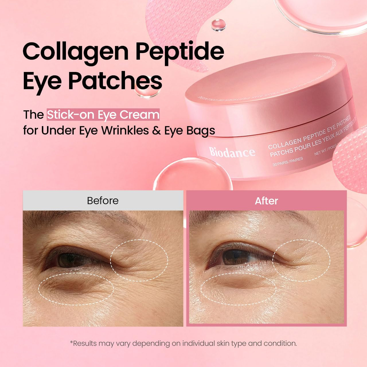 Biodance Collagen Peptide Eye Patches - The Ultimate Anti-Aging Solution